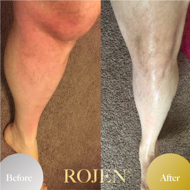 父の日のプレゼントにも🤍

🤩Men's Before and After🤩
https://rojen.jp/tag/mens/

✨️✨️✨️✨️✨️✨️✨️

魔法のひと滴
塗るサプリ🌹
美整オイル®

ROJEN公式サイト
🇯🇵日本
rojen.jp
スキンケアご購入ダイレクトページ
https://rojen.jp/bisei-oil/shop/

🇺🇸USA
rojenusa.com
ROJEN Organic Skincare
https://rojenusa.com/biseioil/

#ROJEN #ロジェン #biseioil #美整オイル #オーガニック #スキンケア #美肌 #紫外線対策 #紫外線 #シミ対策 #シワ対策 #乾燥肌対策 #免疫力強化 #弾力ある肌に変身