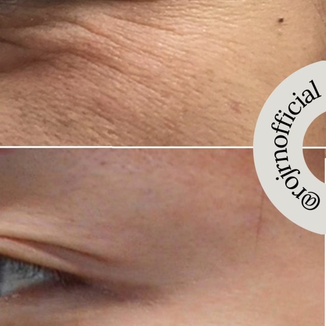 美整オイルビフォーアフター特集⭐️
美整オイルをただ塗ってるだけ。
ホントにただ塗ってるだけで、
こんなに変わっちゃった
喜びの声特集です❣️
https://rojen.jp/category/before-and-after/
✨✨✨ 💖 ✨✨✨
🇯🇵日本
ROJEN公式サイト
rojen.jp
スキンケアご購入ダイレクトページ
https://rojen.jp/bisei-oil/shop/
メルマガ登録でいち早くお知らせGET❣️
https://rojen.jp/mailmagazine/
公式LINE登録で特別メッセージをGET❣️
https://lin.ee/EdDlMnt
インスタフォロー＆Facebookフォロー
https://www.instagram.com/rojenofficial/
https://www.facebook.com/rojen.biseioil/
✨✨✨ 💖 ✨✨✨
🇺🇸USA
ROJEN Official
rojenusa.com
ROJEN Organic Skincare 
https://rojenusa.com/biseioil/
Subscribe by Email:
https://rojenusa.com/newsletter/
Follow on Instagram:
https://www.instagram.com/rojenofficial/
✨ You’ll receive exclusive discounts and
 special offers with every newsletter!
#ROJEN #ロジェン #biseioil #美整オイル #魔法の5秒リフト #塗るサプリメント #ビフォーアフター #弾力ある肌に変身 #ほうれい線 #目元のたるみ #シミ対策 #シワ対策 #乾燥肌ケア #乾燥肌対策 #毛穴の黒ずみ #肌のシミ