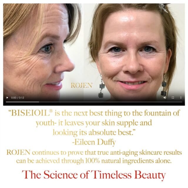 美整オイル🌹
ビフォーアフター特集⭐️

美整オイルをただ塗ってるだけ。
ホントにただ塗ってるだけで、
こんなに変わっちゃった
喜びの声特集です❣️

https://rojen.jp/category/before-and-after/

✨✨✨ 💖 ✨✨✨
🇯🇵日本
ROJEN公式サイト
rojen.jp
スキンケアご購入ダイレクトページ
https://rojen.jp/bisei-oil/shop/
メルマガ登録でいち早くお知らせGET❣️
https://rojen.jp/mailmagazine/
公式LINE登録で特別メッセージをGET❣️
https://lin.ee/EdDlMnt
インスタフォロー＆Facebookフォロー
https://www.instagram.com/rojenofficial/
https://www.facebook.com/rojen.biseioil/
✨✨✨ 💖 ✨✨✨
🇺🇸USA
ROJEN Official
rojenusa.com
ROJEN Organic Skincare 
https://rojenusa.com/biseioil/
Subscribe by Email:
https://rojenusa.com/newsletter/
Follow on Instagram:
https://www.instagram.com/rojenofficial/
✨ You’ll receive exclusive discounts and
 special offers with every newsletter!
#ROJEN #ロジェン #biseioil #美整オイル #魔法の5秒リフト #塗るサプリメント #ビフォーアフター #弾力ある肌に変身 #ほうれい線 #目元のたるみ #シミ対策 #シワ対策 #乾燥肌ケア #乾燥肌対策 #毛穴の黒ずみ #肌のシミ