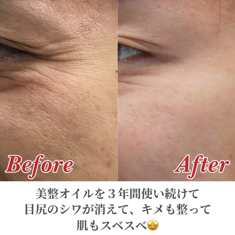 オーガニックスキンケア　ロジェン