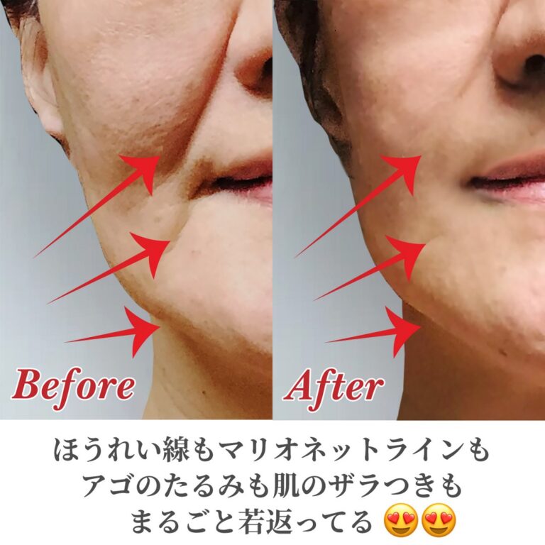 オーガニックスキンケア　ロジェン